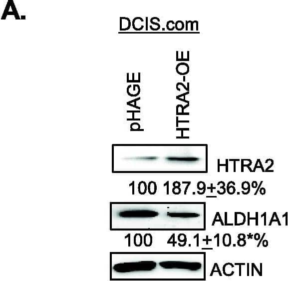 Detection of Human Aldehyde Dehydrogenase 1-A1/ALDH1A1 by Western Blot