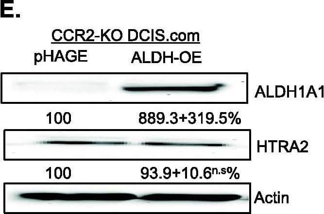 Detection of Human Aldehyde Dehydrogenase 1-A1/ALDH1A1 by Western Blot