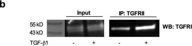 Detection of Mouse TGF-beta RI/ALK-5 by Western Blot