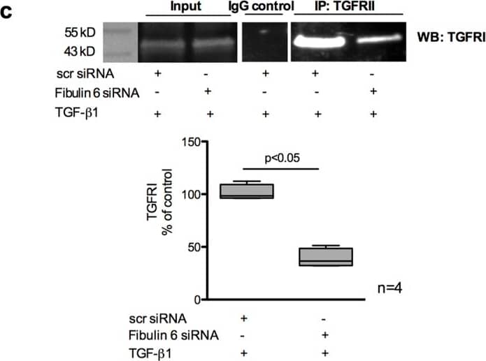 Detection of Mouse TGF-beta RI/ALK-5 by Western Blot