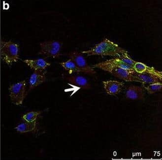 Detection of Human IL-1 beta/IL-1F2 by Immunocytochemistry/Immunofluorescence