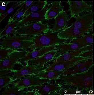 Human IL-1 beta/IL-1F2 Antibody (MAB601) | Bio-Techne