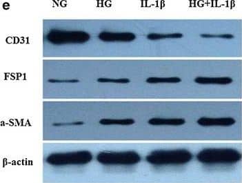 Detection of Human IL-1 beta/IL-1F2 by Western Blot