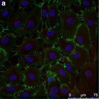 Detection of Human IL-1 beta/IL-1F2 by Immunocytochemistry/Immunofluorescence