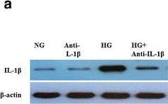 Detection of Human IL-1 beta/IL-1F2 by Western Blot