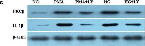 Detection of Human IL-1 beta/IL-1F2 by Western Blot