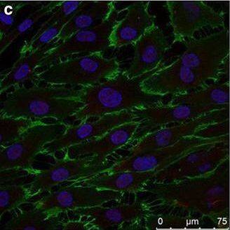 Detection of Human IL-1 beta/IL-1F2 by Immunocytochemistry/Immunofluorescence