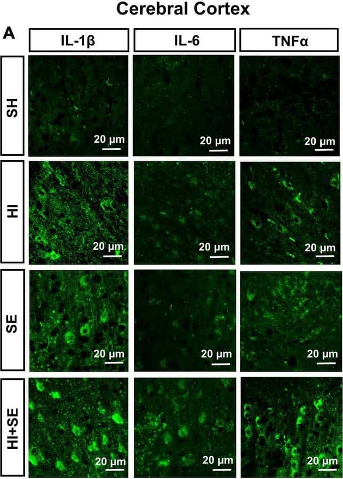 Human IL-1 beta/IL-1F2 Antibody (MAB601) | Bio-Techne