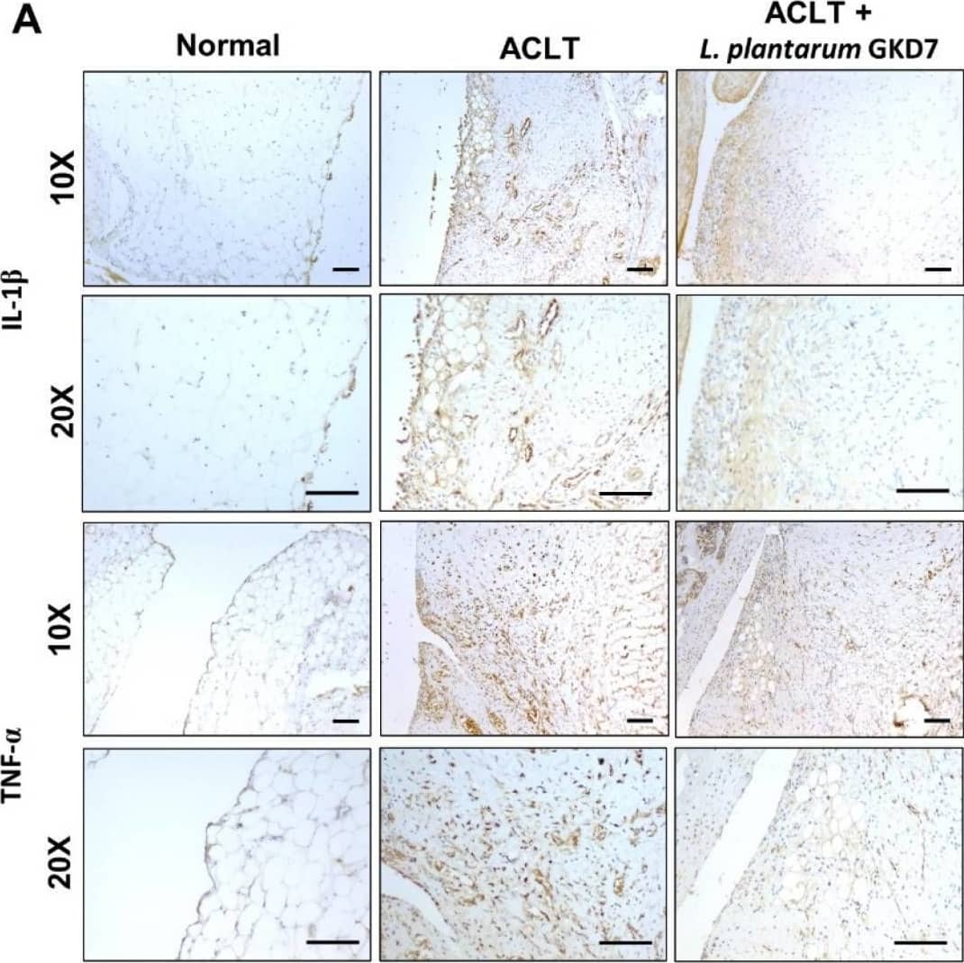 Detection of IL-1 beta/IL-1F2 by Immunohistochemistry