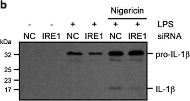 Detection of Human IL-1 beta/IL-1F2 by Western Blot