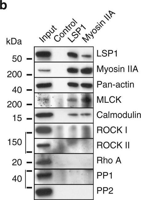 Detection of Human PP1 alpha/PPP1A by Western Blot