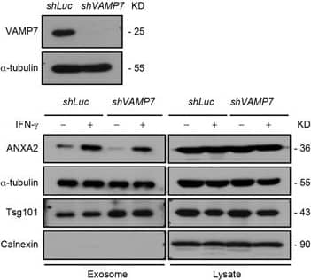Detection of Human VAMP-7 by Western Blot