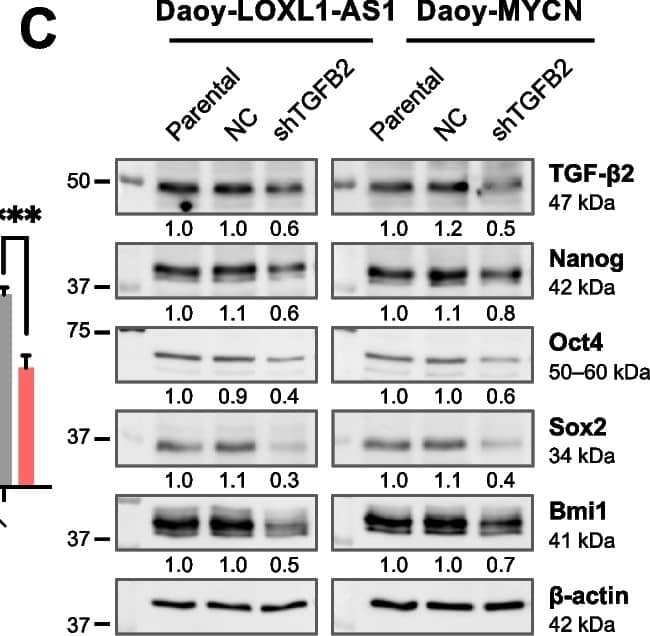 Detection of TGF-beta 2 by Western Blot