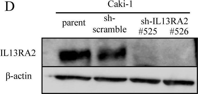 Detection of IL-13 R alpha 2 by Western Blot