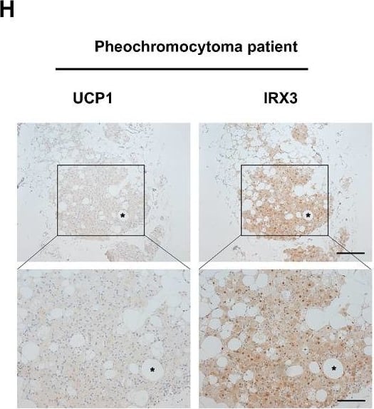 Detection of Mouse UCP1 by Immunohistochemistry