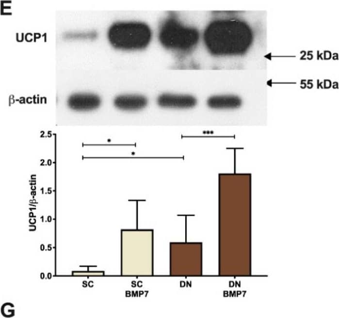 Detection of Human UCP1 by Western Blot