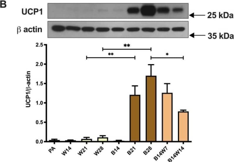 Detection of Human UCP1 by Western Blot