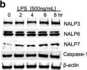 Detection of GM-CSF by Western Blot