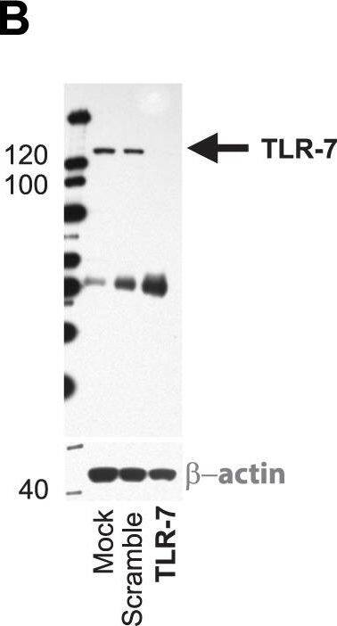 Detection of Human TRIF/TICAM1 by Western Blot