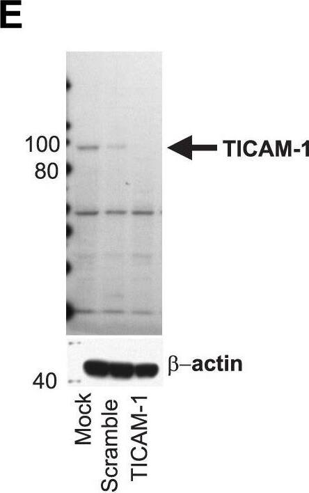 Detection of Human TRIF/TICAM1 by Western Blot