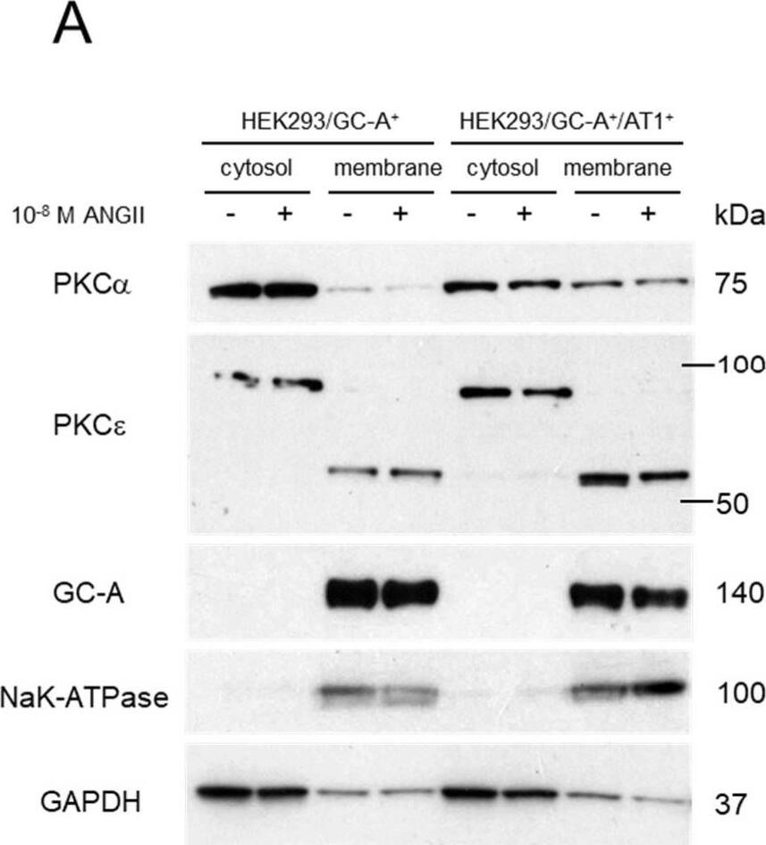 Detection of NPRA/NPR1 by Western Blot
