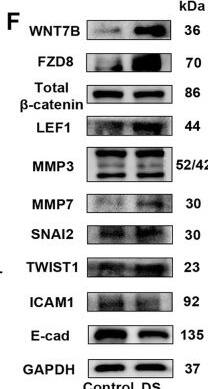 Detection of Twist-1 by Western Blot