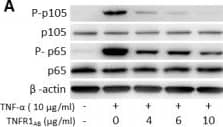 Detection of TNF RI/TNFRSF1A by Western Blot Detection of TNF RI/TNFRSF1A by Western Blot