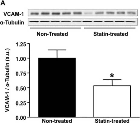 Detection of Mouse VCAM-1/CD106 by Western Blot
