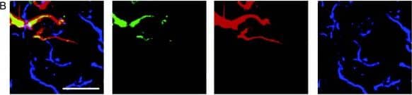 Detection of Mouse Wnt-5a by Immunocytochemistry/Immunofluorescence