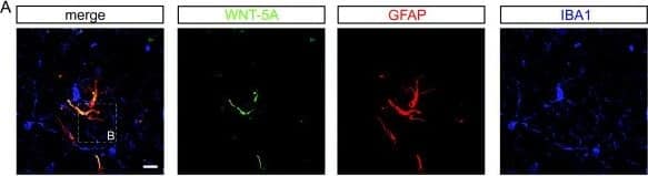 Detection of Mouse Wnt-5a by Immunocytochemistry/Immunofluorescence