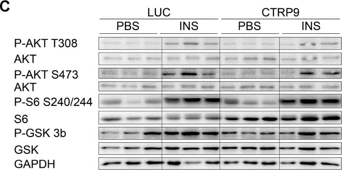 Detection of CTRP9/C1qTNF9 by Western Blot