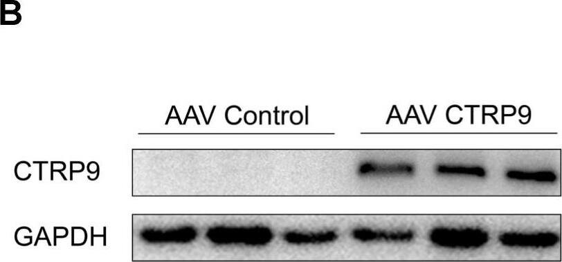 Detection of CTRP9/C1qTNF9 by Western Blot