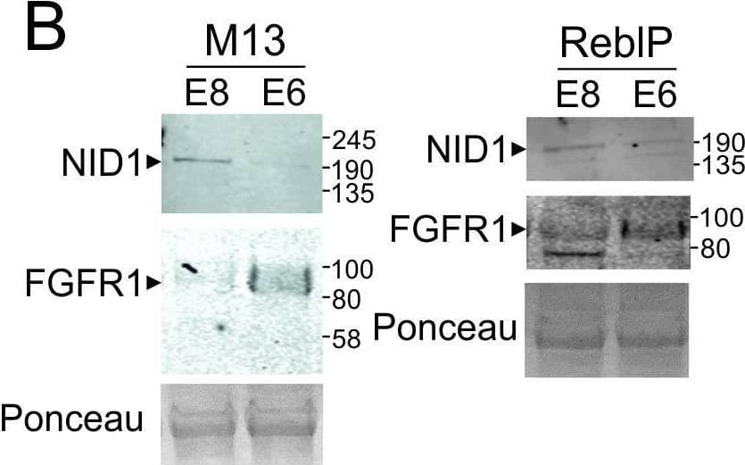 Detection of Human FGFR1 by Western Blot