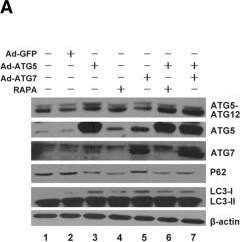 Detection of Human ATG7 by Western Blot