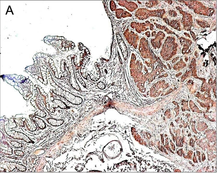 Detection of Human CTGF/CCN2 by Immunohistochemistry
