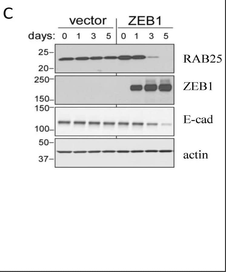 Detection of Human Human ZEB1 Antibody by Western Blot