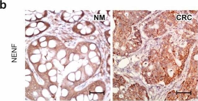 Detection of Neudesin by Immunohistochemistry
