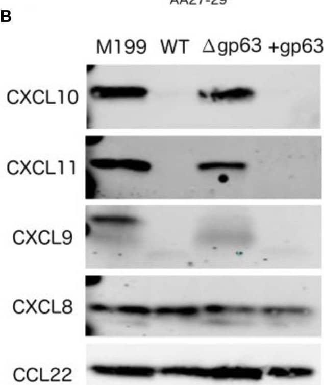 Detection of CXCL11/I-TAC by Western Blot