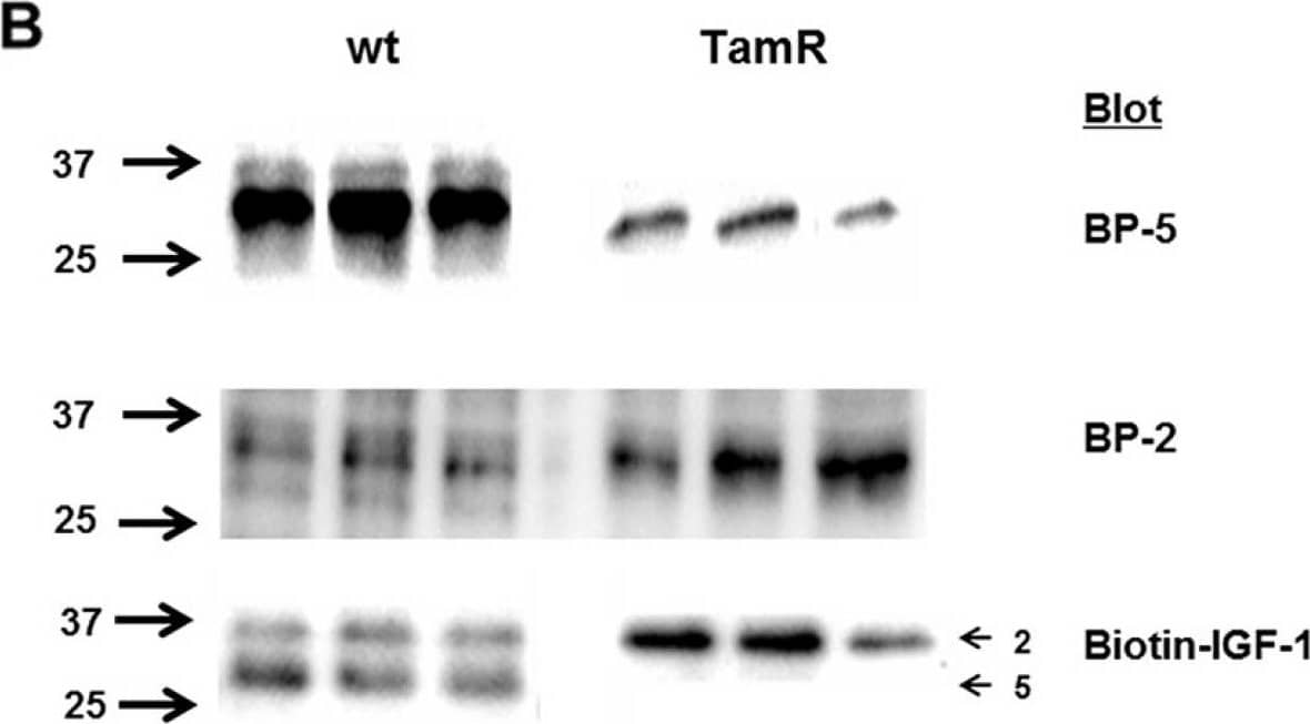 Detection of Human Human IGFBP-2 Antibody by Western Blot