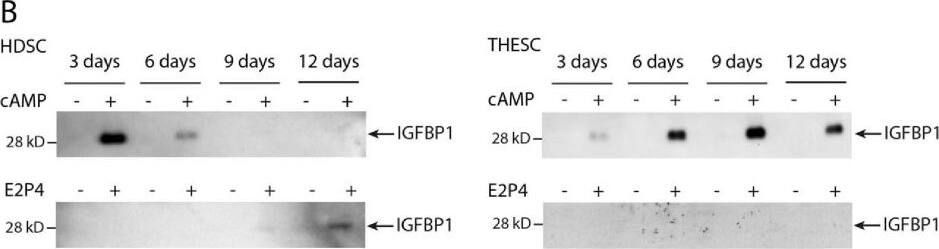 Detection of Human IGFBP-1 by Western Blot