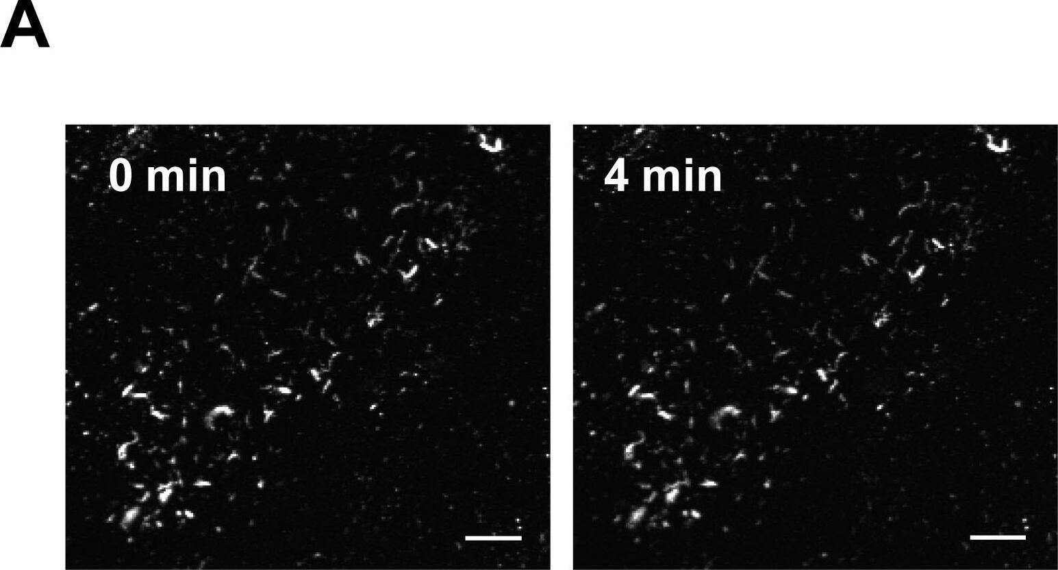Detection of Human CCL5/RANTES by Immunocytochemistry/Immunofluorescence