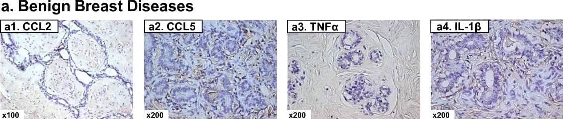Detection of Human CCL2/JE/MCP-1 by Immunohistochemistry