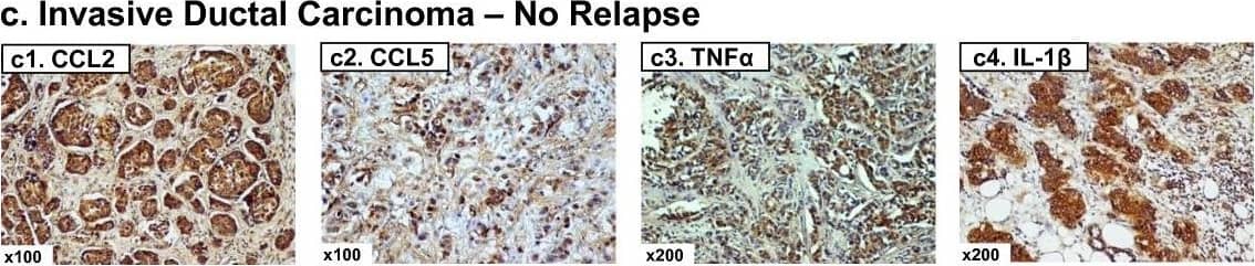 Detection of Human CCL2/JE/MCP-1 by Immunohistochemistry