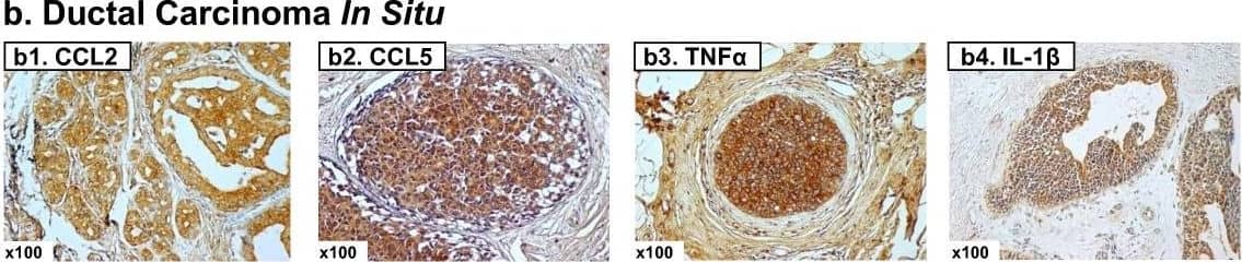 Detection of Human CCL2/JE/MCP-1 by Immunohistochemistry