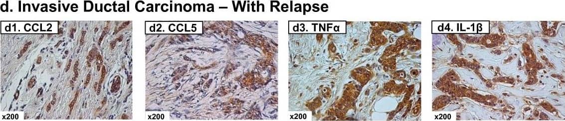 Detection of Human CCL2/JE/MCP-1 by Immunohistochemistry