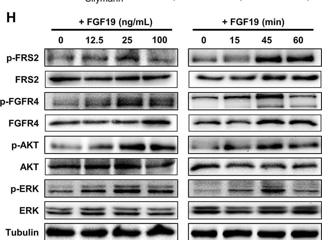 Detection of FGFR4 by Western Blot