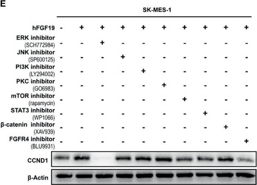 Detection of FGFR4 by Western Blot