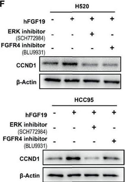 Detection of FGFR4 by Western Blot