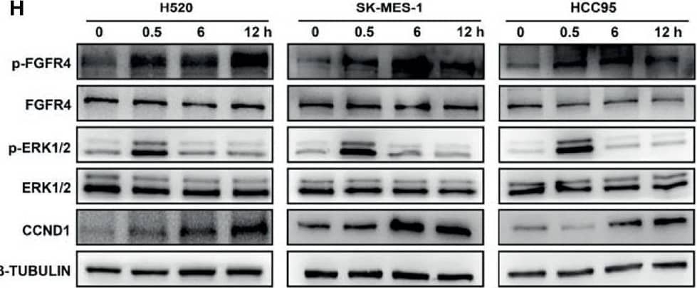 Detection of FGFR4 by Western Blot