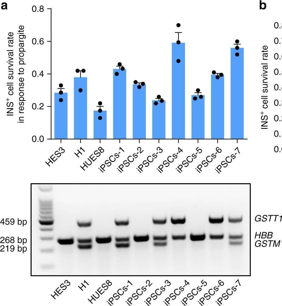 Detection of Glutathione S-Transferase mu 1/GSTM1 by Western Blot